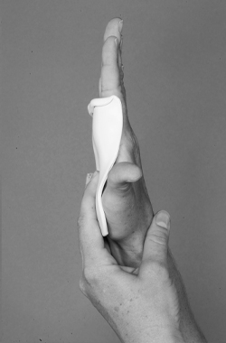 Straighten the fingers 