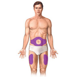Ilustration highlighting the two areas you can give a subcutaneous injection. The abdomen area and either thigh. 