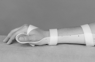 Thumb in splint