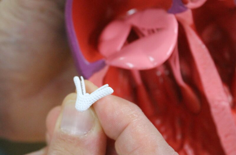 Real-size model of the MitraClip