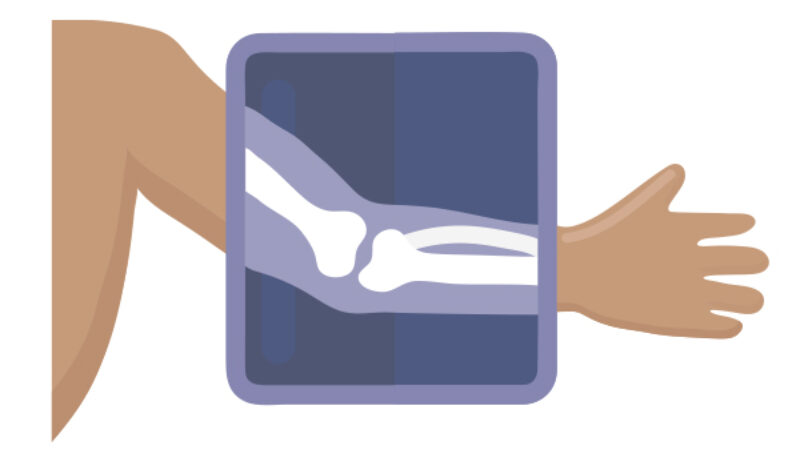 arm xray