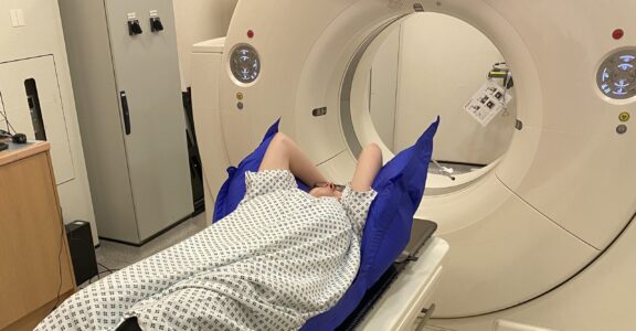 Patient lying on radiotherapy CT couch