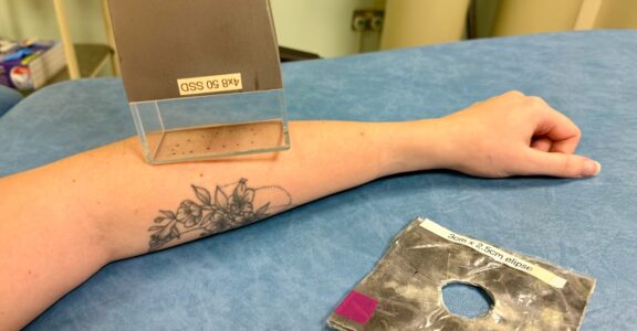 Patient receiving treatment to the arm