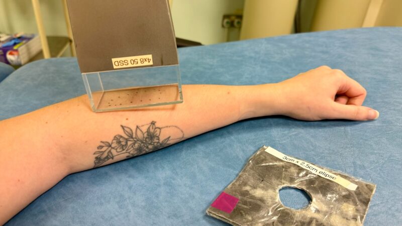 Patient receiving treatment to the arm